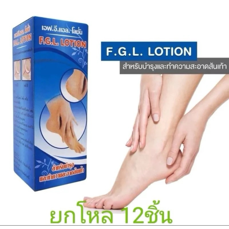 F.G.L. LOTION น้ำยาแช่เท้า (บำรุงส้นเท้าที่แห้งและแตก) (12กล่อง)