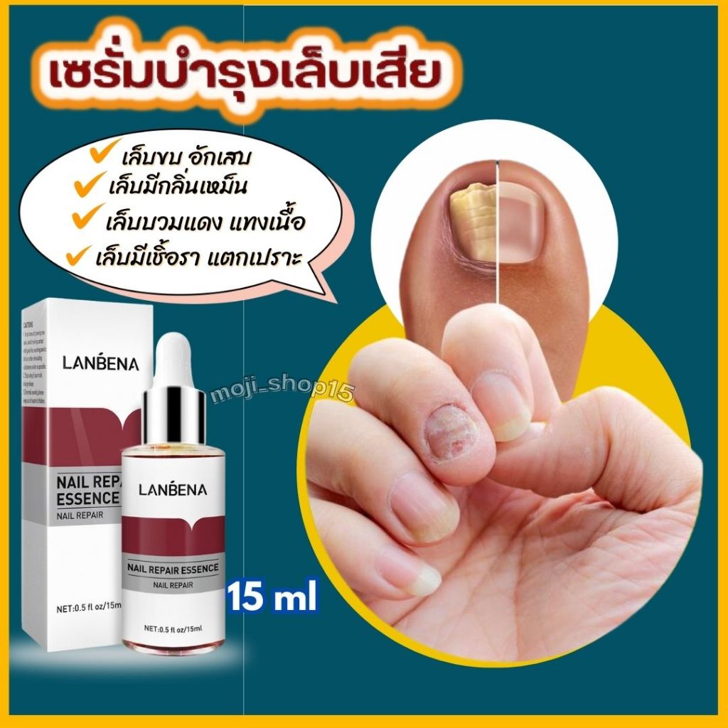 🌈 Lanbena เซรั่มบำรุงเล็บ [ ของแท้ ]  ซ่อมแซ่มเล็บเสีย  เล็บขบ เล็บแตกเปาะ เชิ่อ ร า เล็บ  ปริมาณ 15 ml
