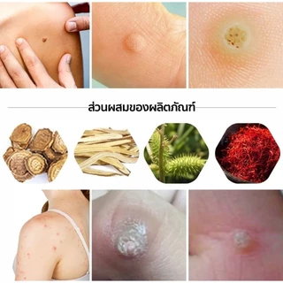 24ชิ้น/กล่อง MQ Corn พลาสเตอร์หูด ตาปลา Corn Plaster Removel เอ็ม คิว พลัส