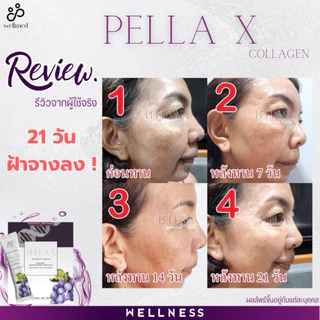 ✨สูตรคุณหมอ✨คอลลาเจน 7 ระบบ จบทุกปัญหา ฝ้า สิว ผิว ผม ไขข้อ ริ้วรอย หน้าเด็ก- wellmed ของแท้ส่งตรงจากบริษัท