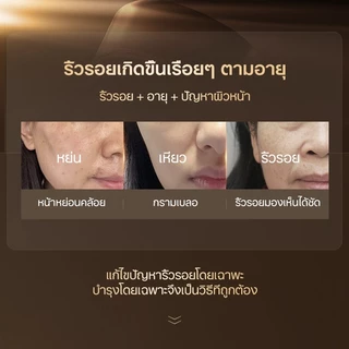 ครีมต่อต้านริ้วรอย ครีมลดริ้วรอย HOMER 50ml ลดริ้วรอยทุกชนิด ริ้วรอยหน้าผาก รอยร่องแก้ม ริ้วรอยตืนกา