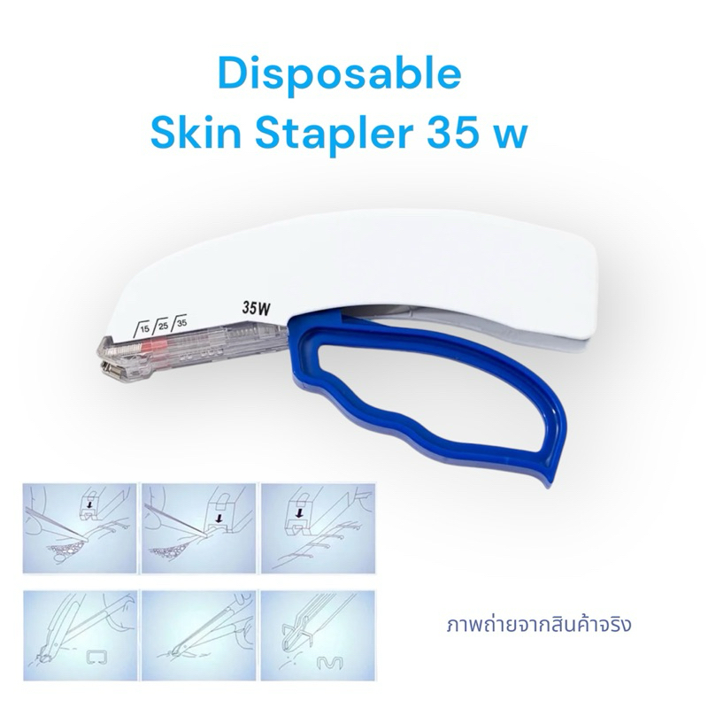 เเม็กเย็บแผล Disposable Skin Stapler 35 W (10 ชิ้น/กล่อง)