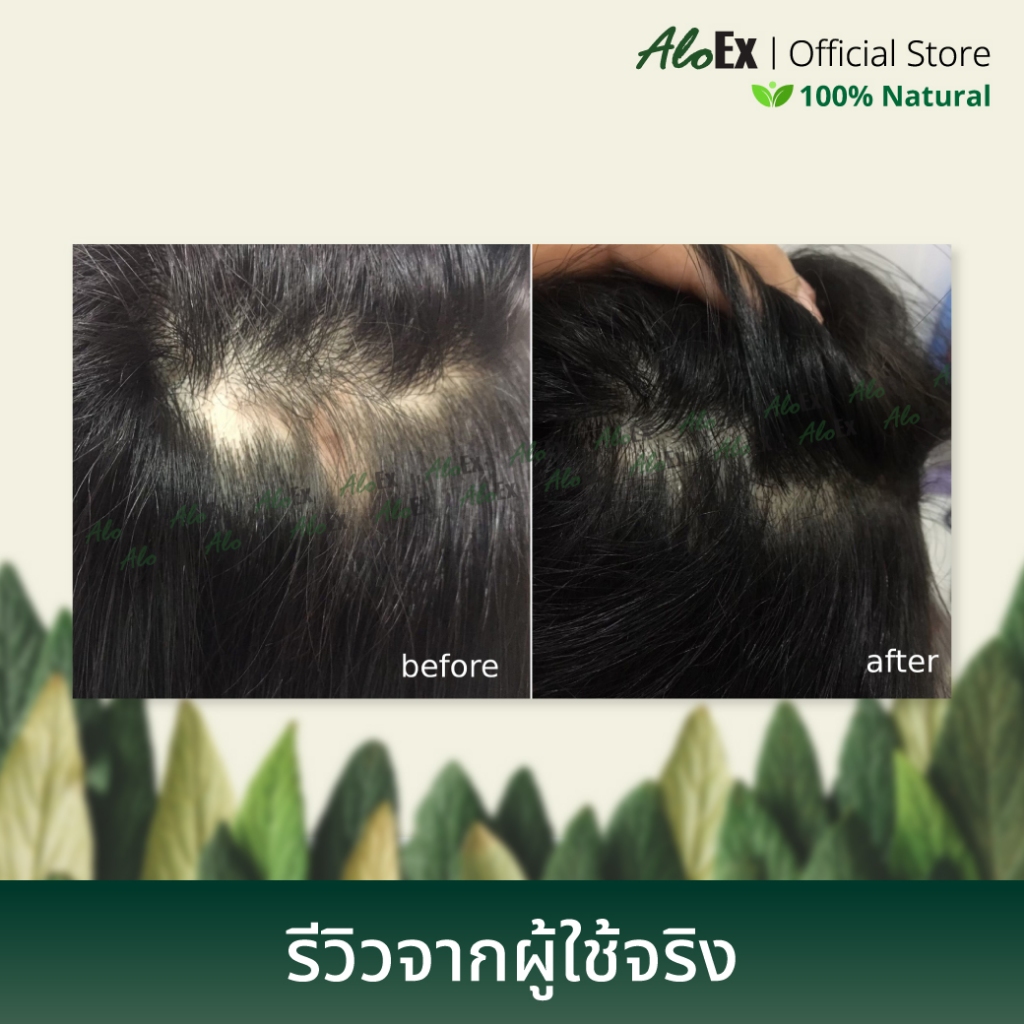 AloEx Hair Serum 120ml ขวดใหญ่ เซรั่มบำรุงหนังศีรษะและเส้นผม ลดผมร่วง สร้างผมใหม่ รากผมแข็งแรง เพิ่มผมหนา - รูปที่ 4