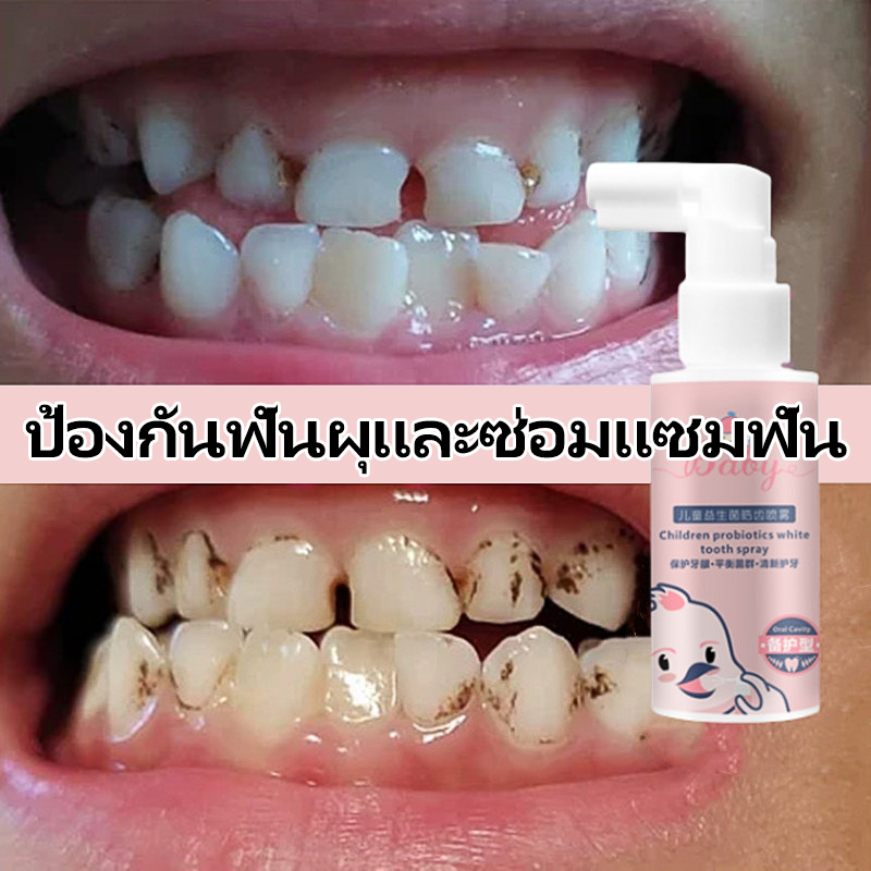 ยาสีฟันเด็ก สเปรย์สำหรับเด็ก สเปรย์ป้องกันฟันผุ 40ML ป้องกันฟันผุ กลืนได้ Food grade ใช้ได้ตั้งแต่ 6 เดือนขึ้นไป ไม่มีน้