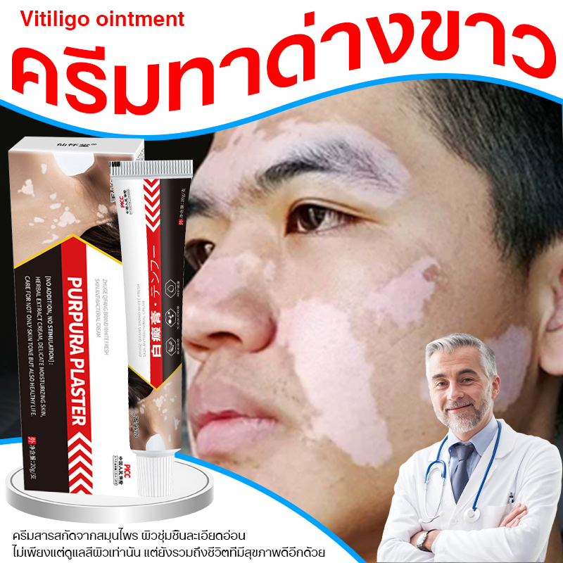 โรคด่างขาว ด่างขาว ครีมทาด่างขาว 20g กำจัดด่างขาวอย่างรวดเร็ว สีผิวไม่เสมอ สารสกัดจากสมุนไพร ส่วนผสมอ่อนโยน