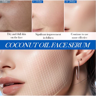 (มีส่งด่วน)SADOER Coconut Oil FACE SERUM เซรั่มมะพร้าว 40ml.