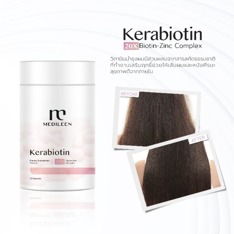 Kerabiotin วิตามินบำรุงเส้นผม มี30แคปซูล