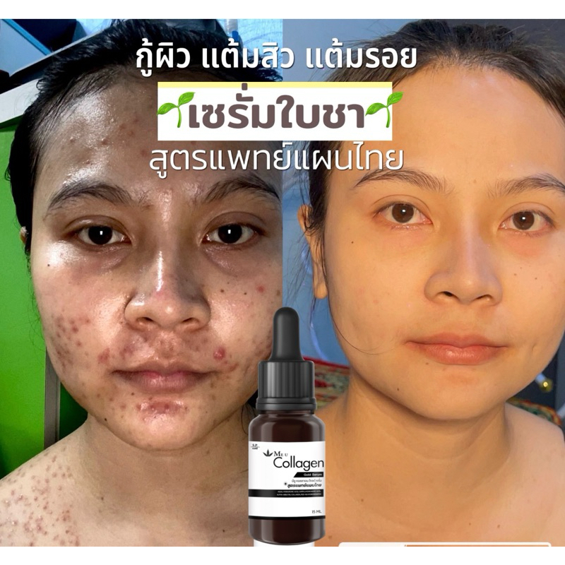 เซรั่มใบชา สูตรแพทย์แผนไทย Collagen Gold Serum
