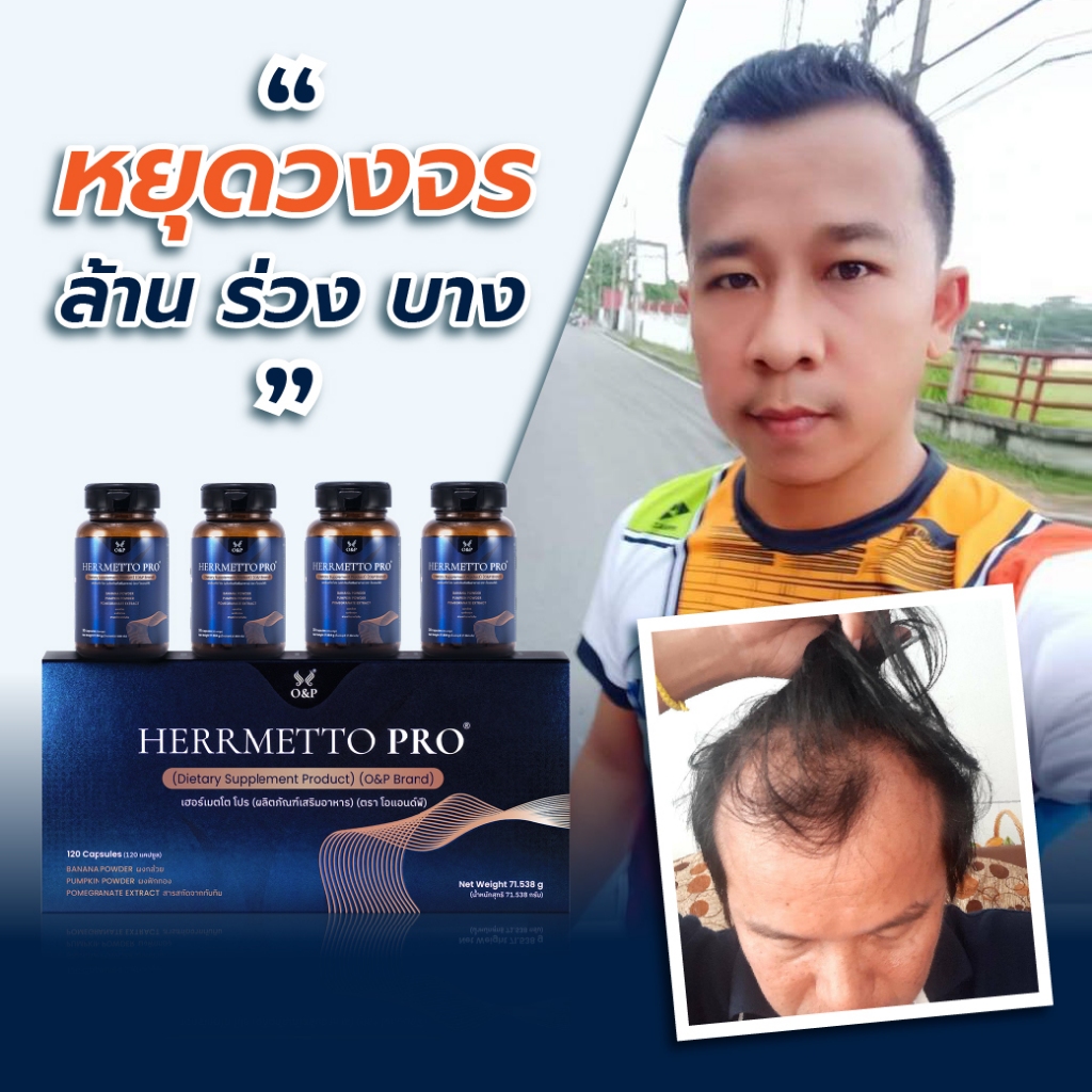 HERRMETTO Pro (เฮอร์เมตโต โปร) คอร์สดูแลเส้นผม แก้ล้าน บำรุงเส้นผม ให้หนาดกดำ ขนาด 120 แคปซูล