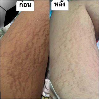 ครีมนวลจันทร์ ลดรอยแตกลาย ของแท้100% (กดผ่านไลฟ์ หรือวิดีโอ30 %ลดสูงสุด 100)