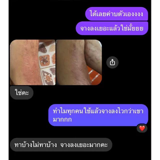 ครีมนวลจันทร์ ลดรอยแตกลาย ของแท้100% (กดผ่านไลฟ์ หรือวิดีโอ30 %ลดสูงสุด 100)