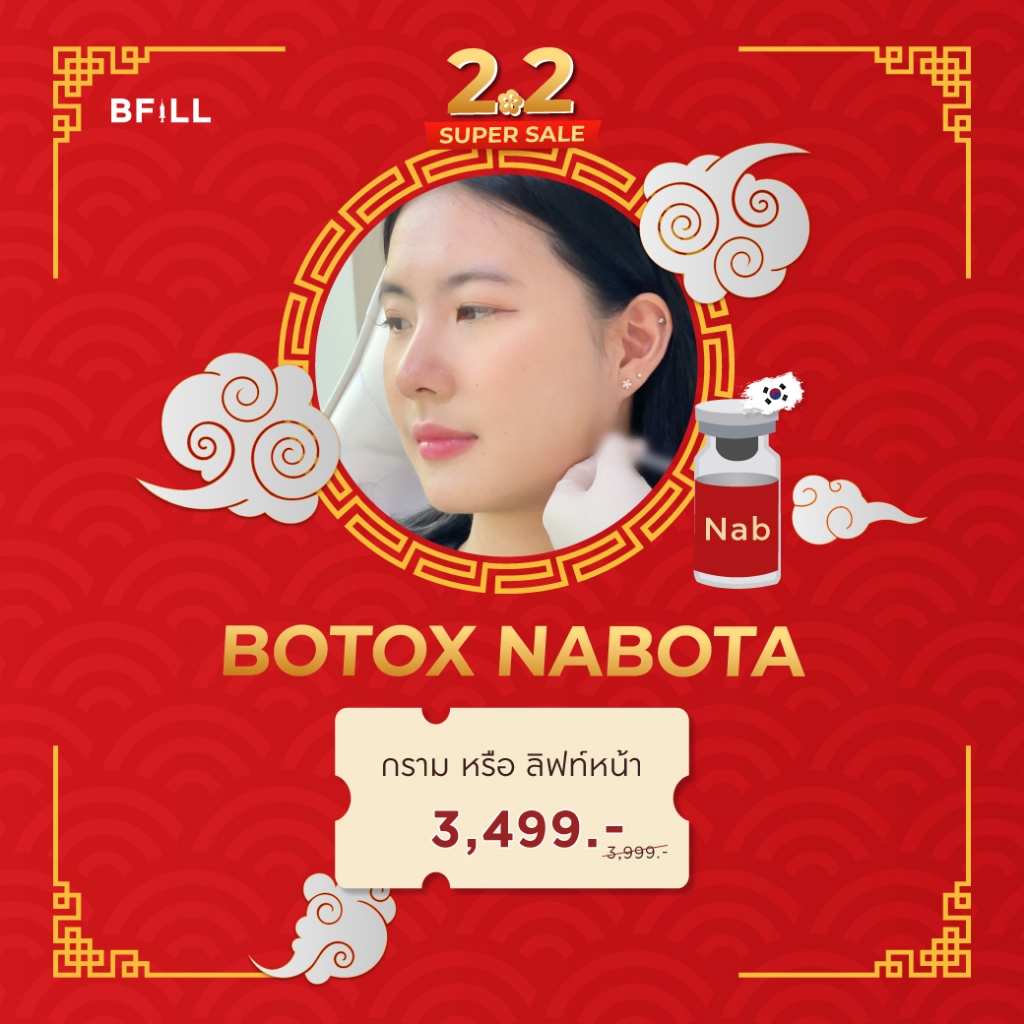 Botox (Nabota) 100 U or Jawline + Face Lift 100 ยู หรือ กราม+ลิฟท์หน้า โบท็อกเกาหลียี้ห้อเดียวที่ได้