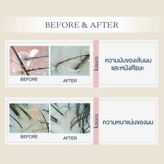 [ Set 2 คู่ ] Kraam Hair&Scalp Detoxifying Shampoo + Detoxifying Conditioner