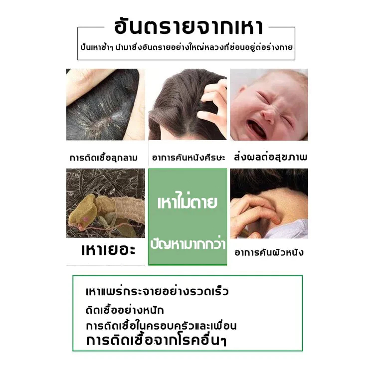 กำจัดเหาแชมพูกำจัดเหา ทำลายเหาทั้งหมด ยาฆ่าเหาใช้สูตรอ่อนโยนไม่ระคายเคือง เหมาะสำหรับเด็กและสตรีมีครรภ์