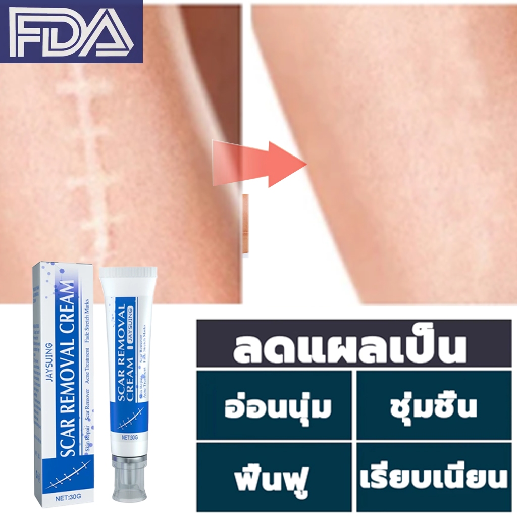 ครีมซ่อมแซมรอยแผลเป็นทางการแพทย์ ครีมลดรอยไหม้หลังผ่าตัด ปรับปรุงผิวที่ไม่สม่ำเสมอ
