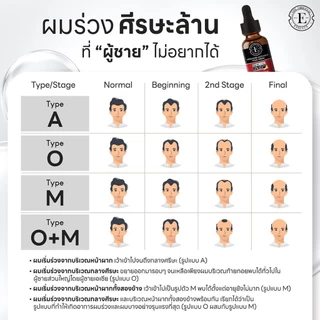 เซรั่มปลูกผม ลดผมเร่ง เร่งผมขึ้น ชะลอผมหงอก ดิออเรนทอล (เซรั่ม 3 ขวด)