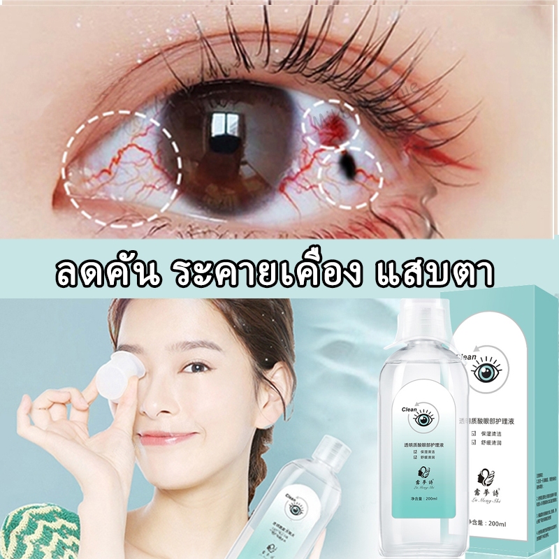 น้ำยาล้างตา ล้างตา ทำความสะอาดดวงตา 200ml บรรเทาอาการเมื่อยล้าของดวงตา ล้างสิ่งแปลกปลอมในดวงตา ลดคัน ระคายเคือง ตาแห้ง