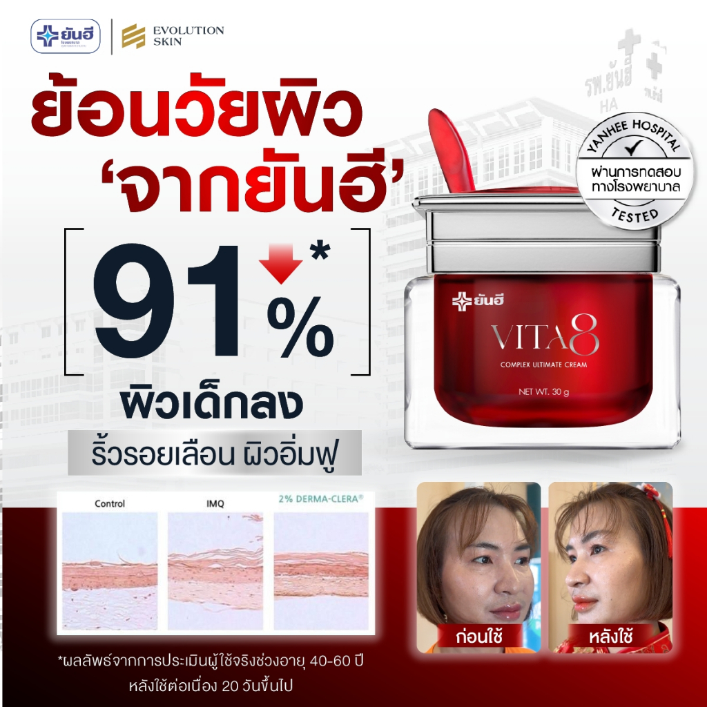 โปรโมชั่น Yanhee Vita8 ยันฮีไวต้า8 ศรีริต้า ครีมลดริ้วรอย ผิวอิ่มฟู นุ่มเด้ง ย้อนวัย ริ้วรอยจางลง - รูปที่ 3