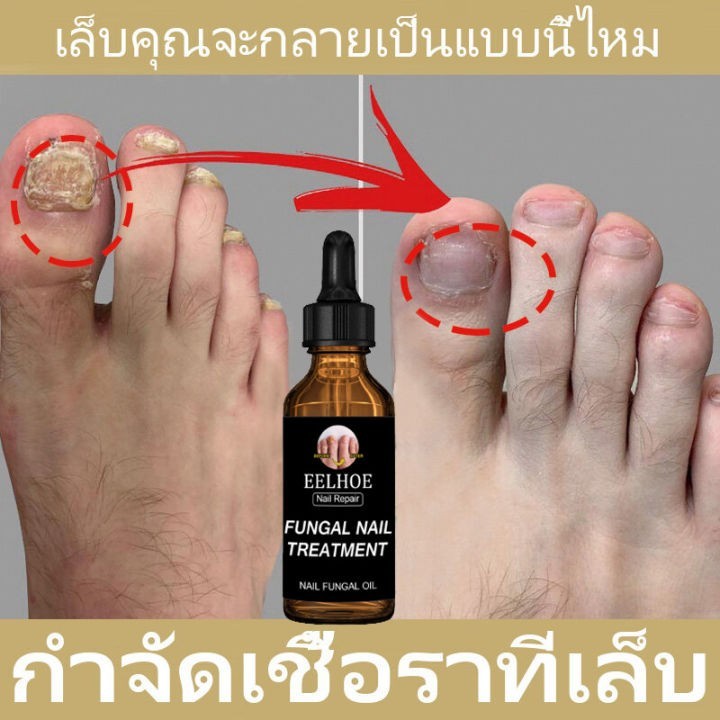 ขิรุงเล็บ30มล เชื้อรานิ้วซ่อมแซมมือการดูแลเล็บเท้าครีมบำรุงเล็บที่อ่อนนุ่มเล็บให้ความชุ่มชื่น