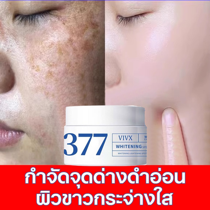 377ครีมแก้ฝ้าผิวขาว อุดมไปด้วยไนอาซินาไมด์ ยับยั้งการสร้างเมลามิน ทาผิวขาว แก้ฝ้าบนหน้า เติมเต็มความ