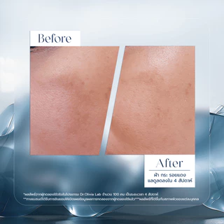 Dr.Olivia Dark Spot Refining Serum 30 ml. (เซรั่มสูตรเข้มข้นช่วยลด ฝ้า กระ จุด ด่าง ดำ เพิ่มความกระจ่างใส)