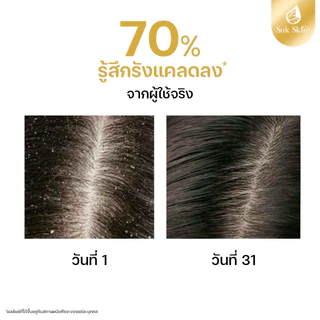 (แท้100%) Suk Skin แชมพูสุขสกิน 150ml แชมพูขจัดรังแค แชมพูลดผมร่วง แชมพูสมุนไพร แชมพูสระผม แบบขวดฝาปั้ม แชมพู