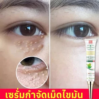 เม็ดไขมัน 30ml ลบคล้ำบวมใต้ตา กระชับรอยตีนกา ลดเม็ดไขมัน ฟื้นฟูผิวตา ครีมทารอบดวงตา เซรั่มอายครีม อายครีม