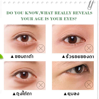 เม็ดไขมัน 30ml ลบคล้ำบวมใต้ตา กระชับรอยตีนกา ลดเม็ดไขมัน ฟื้นฟูผิวตา ครีมทารอบดวงตา เซรั่มอายครีม อายครีม