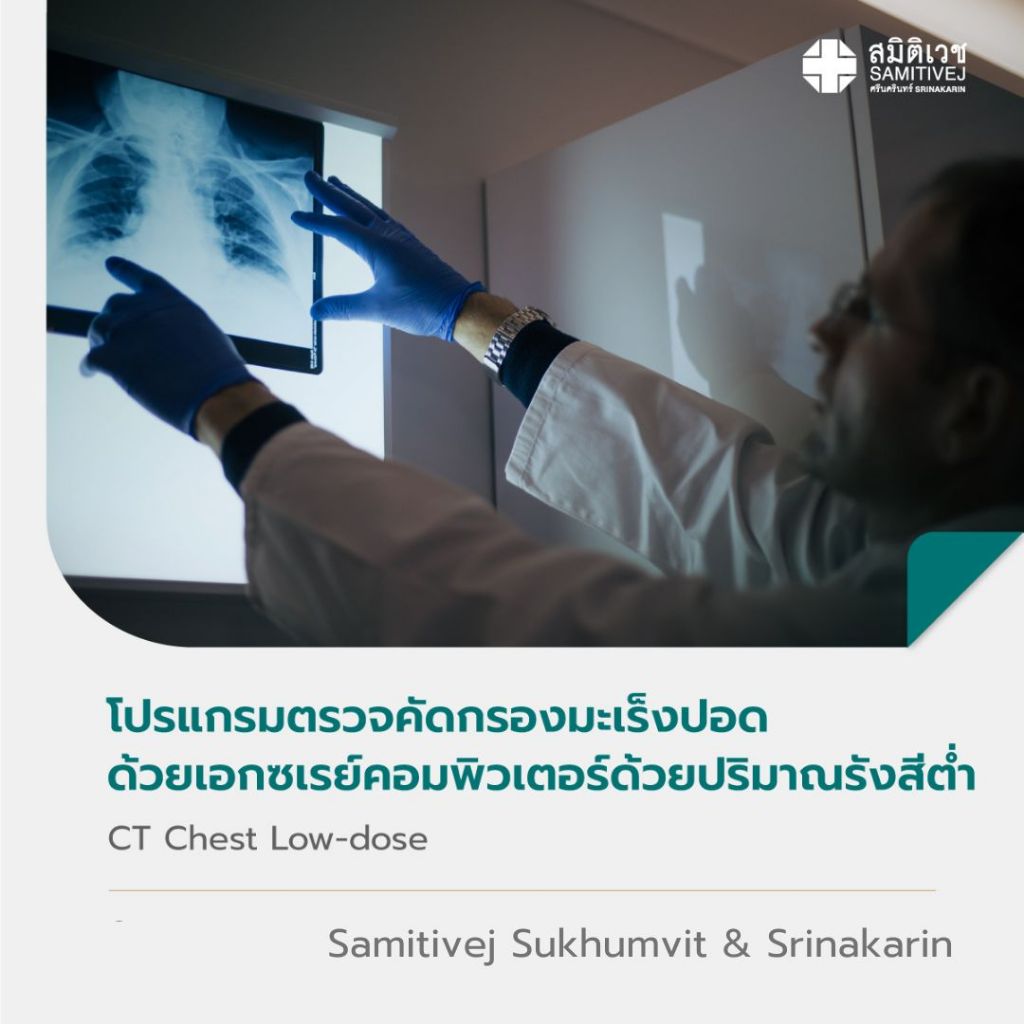 [E-Coupon] โปรแกรมตรวจคัดกรองมะเร็งปอดด้วยเอกซเรย์คอมพิวเตอร์ด้วยปริมาณรังสีต่ำ CT Chest Low-dose สมิติเวช
