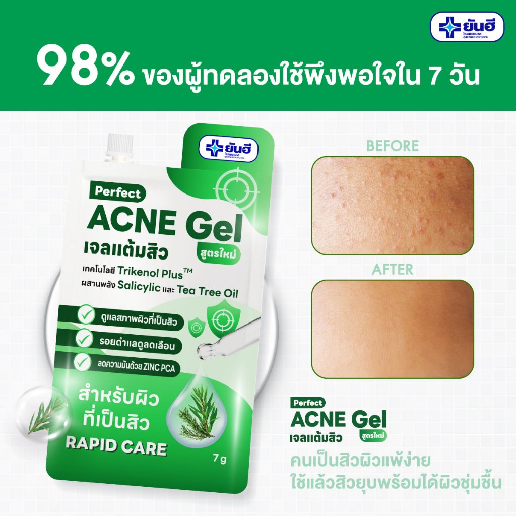 Yanhee Perfect Acne Gel 7g. ยันฮี เจลแต้มสิว สำหรับผิวแพ้ง่าย (แต้มสิว ซองเขียว)