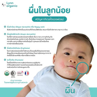 [รางวัลครีมกู้ผิวลูกแห่งปี2025] (โปร2 แถม 1เพียง 110 ) Lynn Organic Ceramide Daily Lotion โลชั่นบำรุงผิวเด็กพรีเมียม