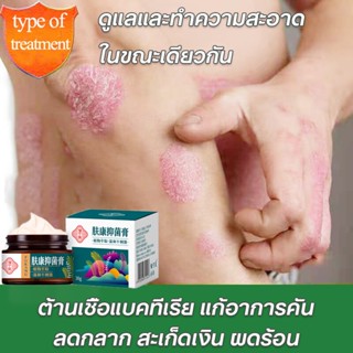 ครีมลดอาการคัน ทาแก้คัน ผิวหนังทากากเกลื้อน สารสกัดจากพืชใช้…