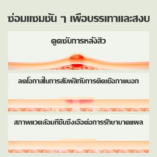 แผ่นแปะสิว 140 ดวง(ผสมสี) รูปดาว สีสันสดใส สําหรับติดตกแต่งสิว แผ่นแปะสิวสีซ่อมแซมหลุมสิวและรอยต่างๆ ทำให้สิวจางลง