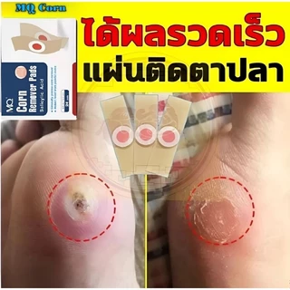 24ชิ้น/กล่อง MQ Corn พลาสเตอร์หูด ตาปลา Corn Plaster Removel เอ็ม คิว พลัส