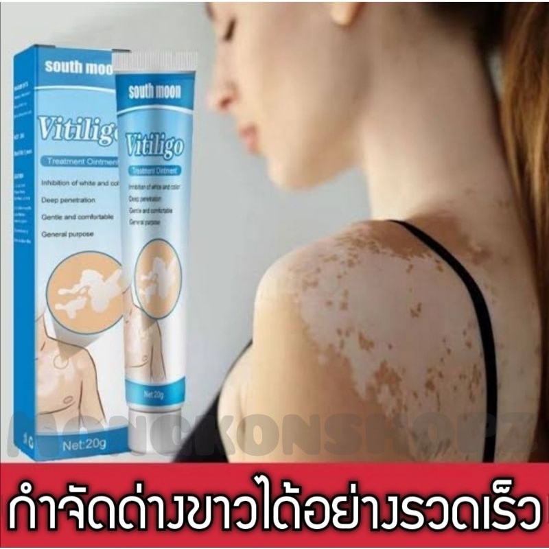ครีมทาด่างขาว แก้ด่างขาวตามร่างกาย กระตุ้นเมลานิน เม็ดสีอย่างมีประสิทธิภาพ 20g