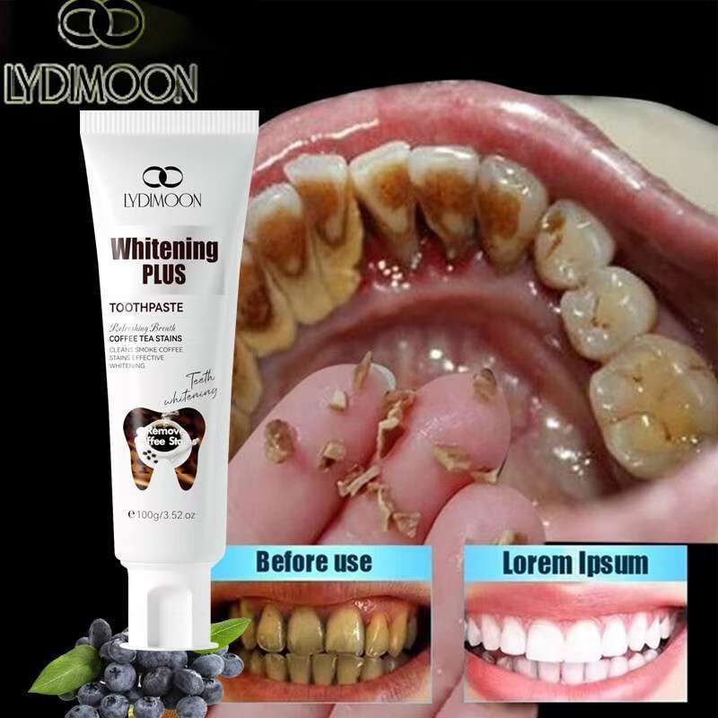 LYDIMOON ยาสีฟันไวท์เทนนิ่ง ฟอกฟันขาว ขจัดคราบหินปูนสีเหลือง 100g ให้ ฟันขาว ยาสีฟันสมุนไพร ช่วยลด หินปูน ฟันเหลือง
