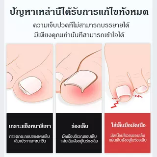COZII ⚡️⚡️กรรไกรตัดเล็บหัวแหลม กรรไกรตัดซอกเล็บ กรรไกร Nail Pedicure