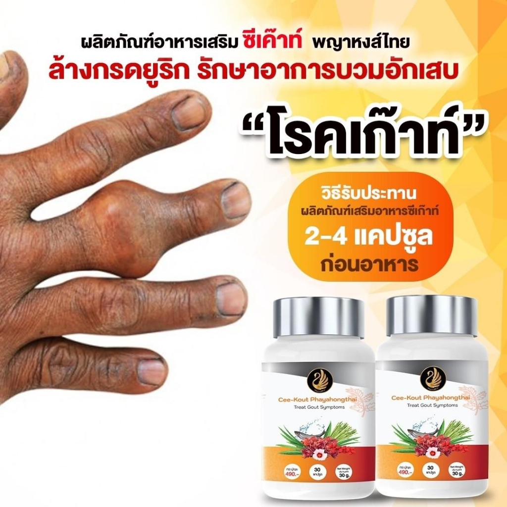 ซีเค๊าท์ พญาหงส์ไทย ลดกรดยูริก ปวดเก๊าท์ ปวดข้อ ปวดเข่า ปวดกล้ามเนื้อ โรคเก๊าท์ รูมาตอยด์