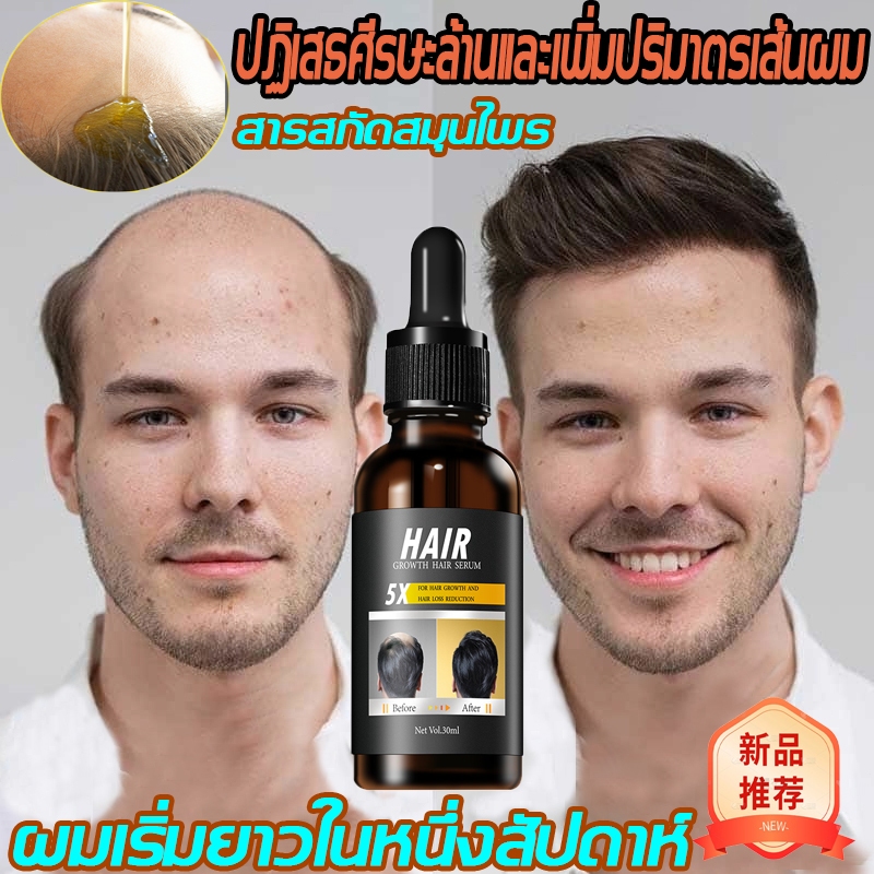 ซรั่มปลูกผม ปลูกผม สเปรย์ปลูกผม ป้องกันผมร่วง น้ำยาเร่งผมยาว ยาปลูกผมของแท้ เพิ่มผมหนา บอกลาหัวล้านเจริญเติบโตและกันผมร่