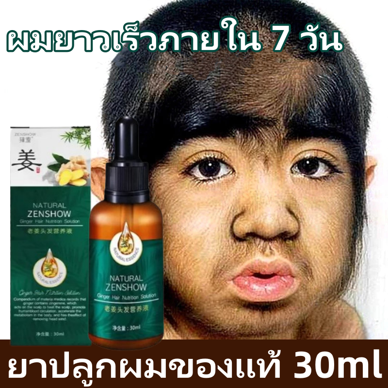 ยาปลูกผมของแท้ น้ำยาเร่งผมยาว เร่งผมยาว น้ำยาปลูกผม เซรั่มปลูกผม ป้องกันผมร่วง บอกลางความบาง บำรุงผม 30ml