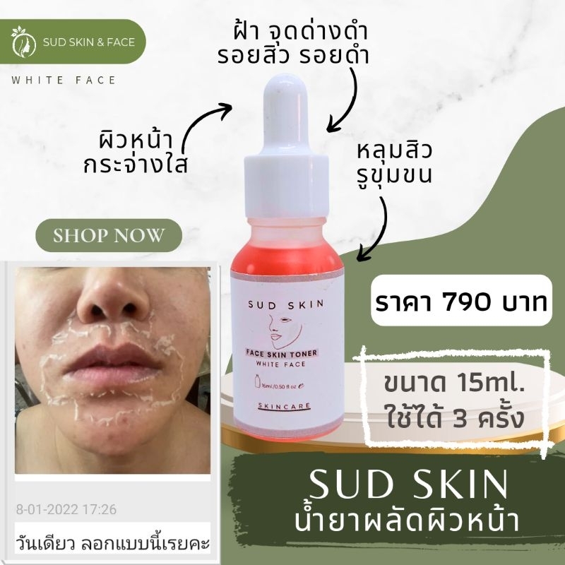 เซรั่มผลัดผิวหน้า รอยสิว ฝ้า กระ จุดด่างดำ