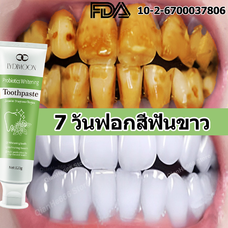 ยาสีฟันฟันขาว ยาสีฟันสมุนไพร ยาสีฟันฟอกฟันขาว 120g ลดฟันเหลือง ลดกลิ่นปาก ขจัดคราบจุลินทรีย์ ลดเหงือกอักเสบ ขายดีใน TK