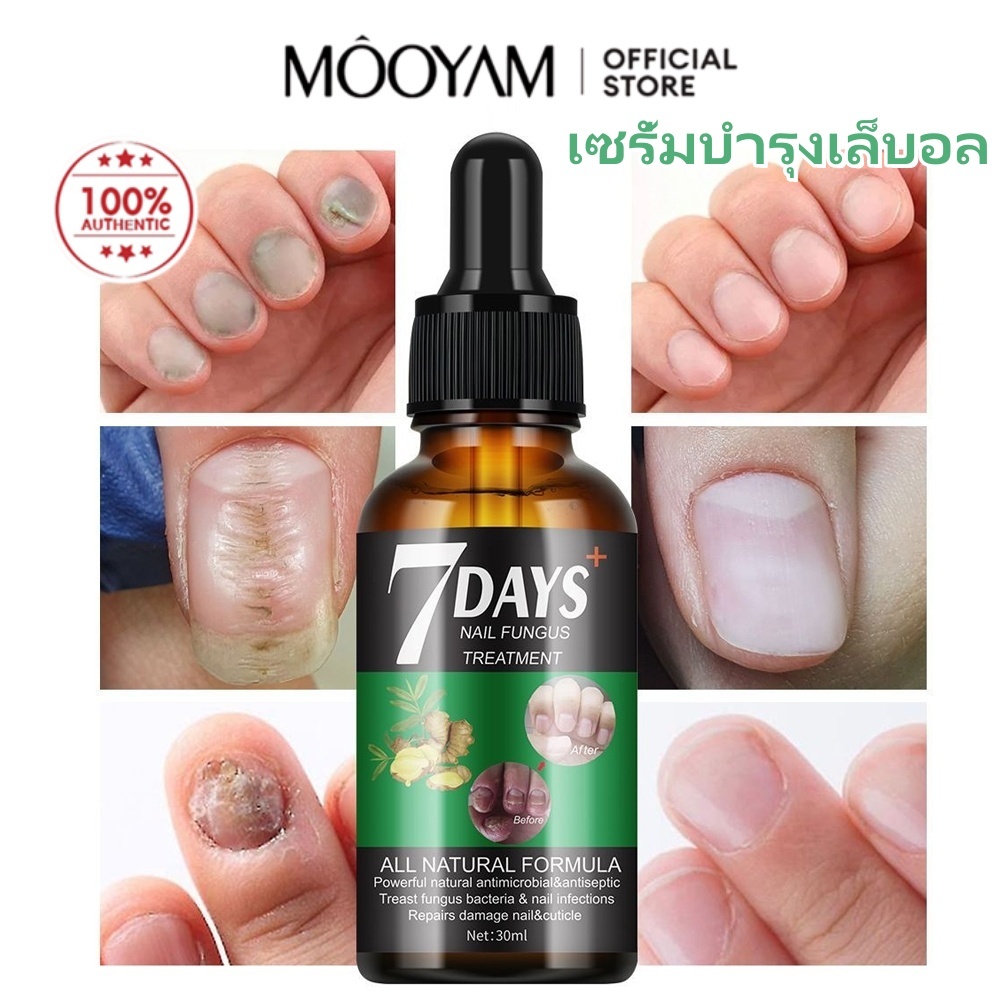 Mooyam เซรั่มเล็บ เซรั่มบำรุงเล็บ สารสกัดจากขิง บำรุงและเสริมสร้างเล็บให้สวยงามเปล่งประกาย 30มล
