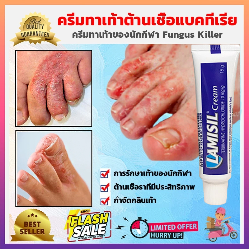 2025สิทธิบัตรของแท้ ครีมระงับกลิ่นเท้า ที่มีประสิทธิภาพ แก้ปัญหา เท้าเหม็น กลิ่นเท้า ลดเหงื่อ รองเท้าเหม็น ดับกลิ่นเท้า
