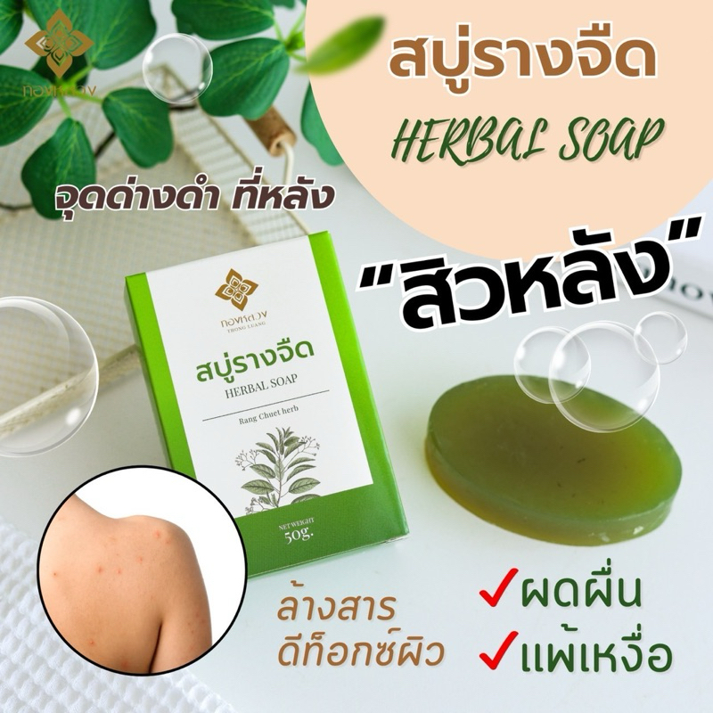 สิวหลัง ผดผื่น ดูเเลด้วย สบู่รางจืด ตราทองหลวง