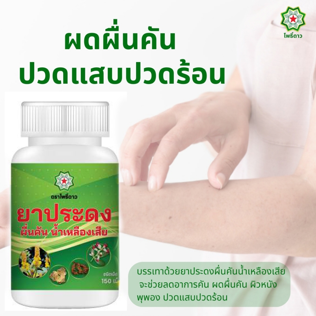 คันตามตัว ผื่น ตุ่มแดง ตามผิว ภูมิไม่ดี ประดง150เม็ด