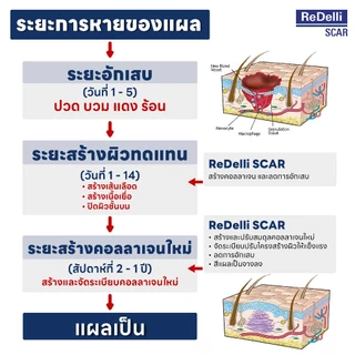 ReDelli SCAR ซิลิโคนเจล ขนาด 9 / 18 กรัม ดูแลป้องกันแผลเป็น ลดแดง นูน คัน นุ่ม จาง และรอยแผลจางลง