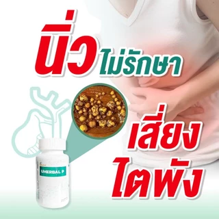 Uherbal P ยูเฮอร์เบิล พี ตัวจริง ตอบโจทย์เรื่องนิ่ว