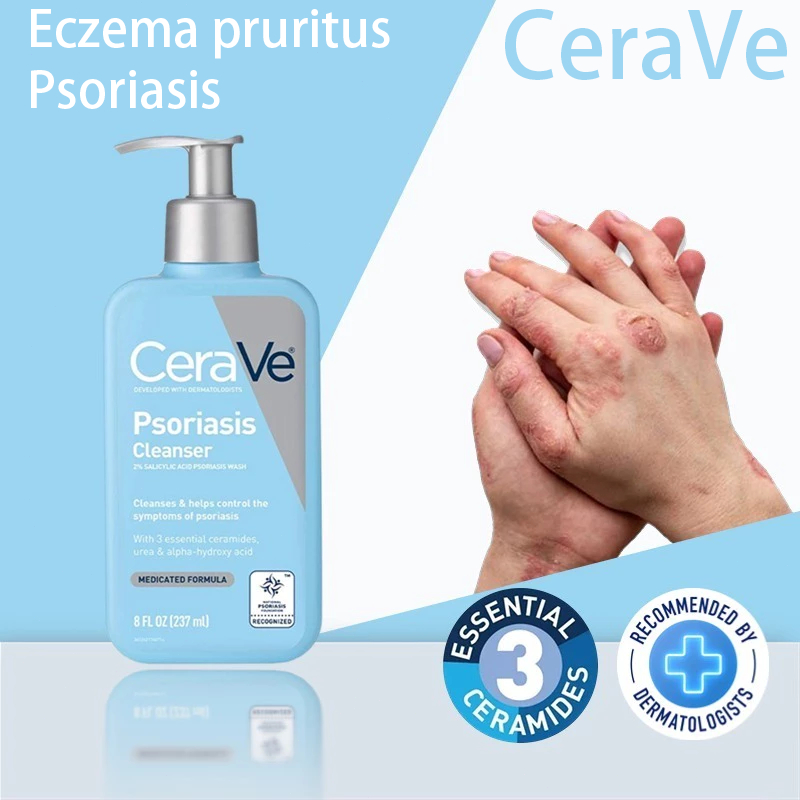 Cleanser สำหรับคนที่ผิวเป็นสะเก็ดเงิน ใช้ตอนอาบน้ำพร้อมกับควบคู่กับครีม Psoriasis 237ML Treatment Wi