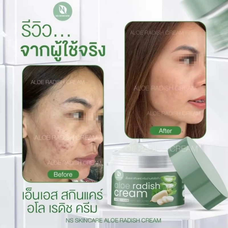 เอ็นเอส สกินแคร์อโลเรดิชครีมตอบโจทย์มุกปัญหาของใบหน้า thumbnail 3